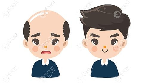 不剃发植发比剃发植发存活率低不可信