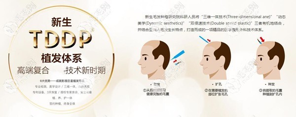 tddp植发和微针哪个好