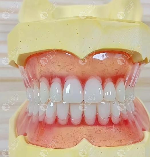 全口树脂假牙能用多久