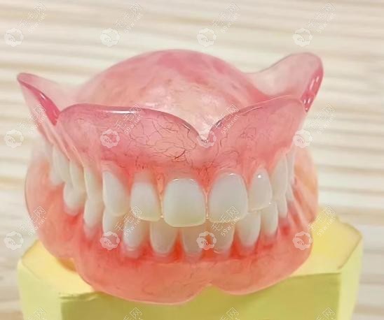 全口义齿2800元一套是什么材质?揭秘树脂假牙3年使用实况