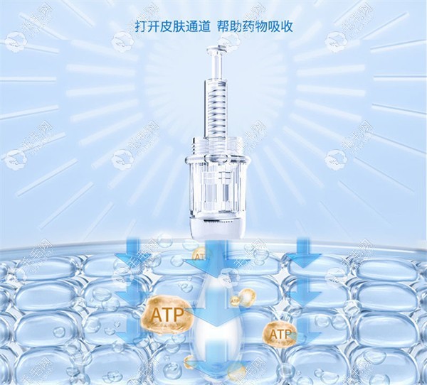 微针生发原理