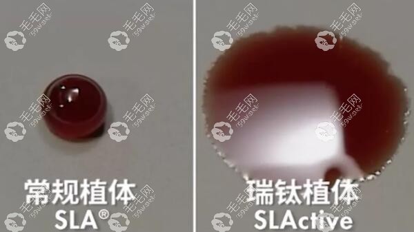 德国瑞钛超亲水植体愈合速度更快