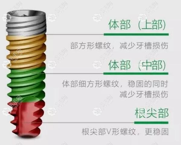 德国瑞钛超亲水植体优势