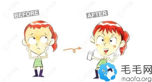 女生种植发际线效果