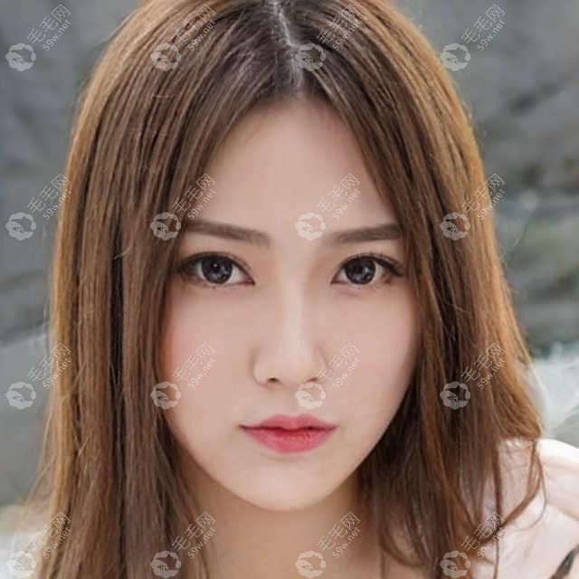 他为什么说“做发际线的后悔了，植发后我宁愿做个光头”
