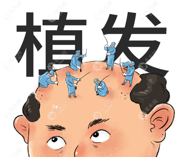 成都植發(fā)機(jī)構(gòu)排名前十名