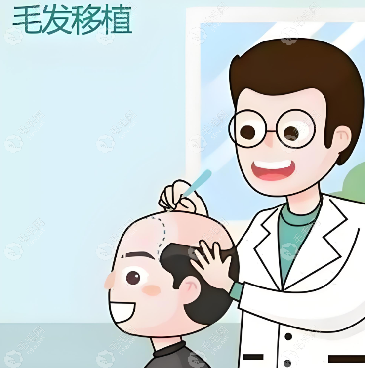 2025发际线种植头发5年后真实感受