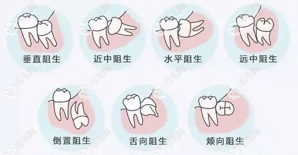 智齒黑了是不是一定要拔掉59w.net
