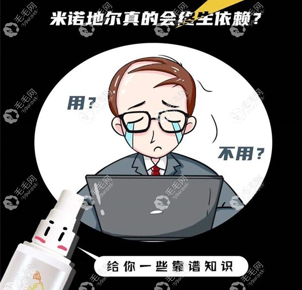 米诺地尔会产生依赖性吗？.jpg