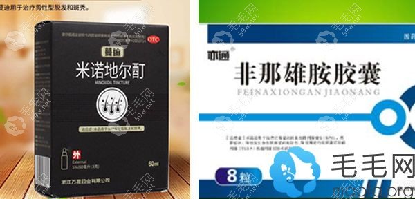 治疗脱发的药物