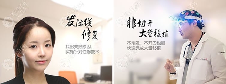 韓國藝麗人女性發(fā)際線矯正與修復(fù)多少錢