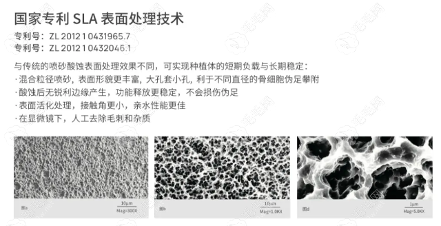 登德瑪種植體表面經(jīng)過 SLA（大顆粒噴砂酸蝕）處理