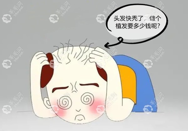 植發(fā)要多少錢呢？