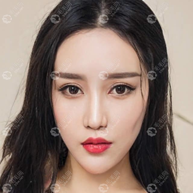 云南大理植发要多少钱?吴氏嘉美/伊美植发际线价格有差别喔