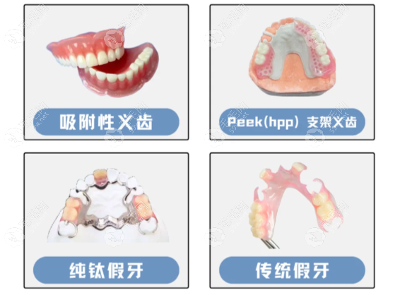 bps吸附性義齒和普通吸附義齒區(qū)別