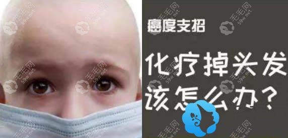 化疗后出现掉头发怎么办