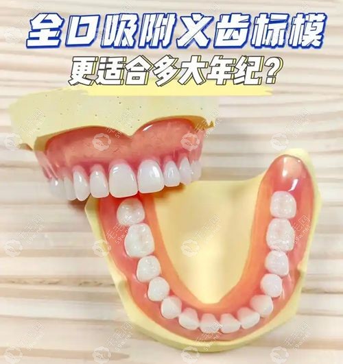 新BPS吸附性义齿价格表:半口7k起|全口1.88w起(含北上广深报价)