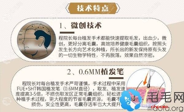 中信惠州植发科技术优势