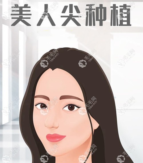 深圳植美人尖手術的價格
