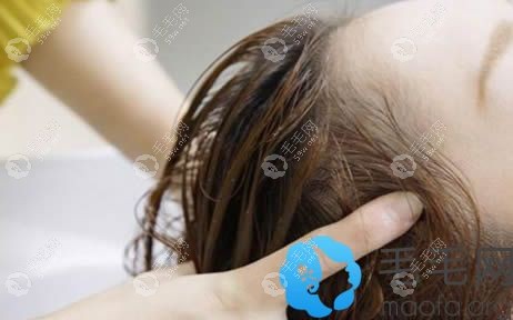 女性洗头掉头发怎么办