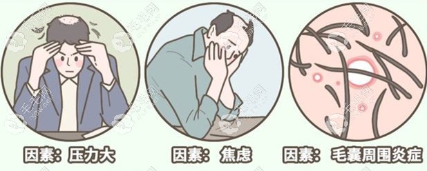 脫發(fā)的原因