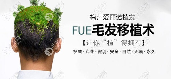 梅州愛麗諾FUE植發(fā)
