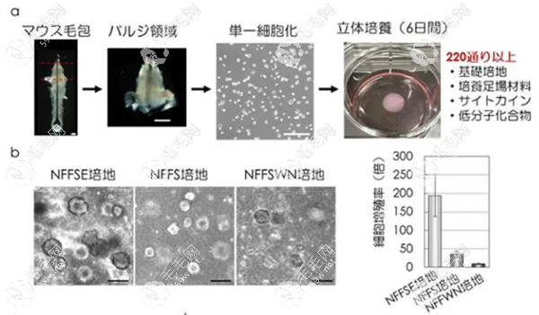 日本头发毛囊再生新技术