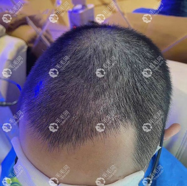 石家庄雅芳亚植发中心