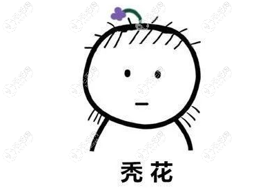 成都做發(fā)際線種植大概得花多少錢