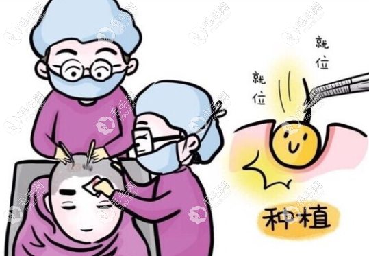 不同的植發(fā)技術(shù)費用不同