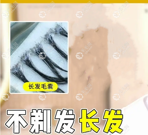 首瑞不剃發(fā)長發(fā)植發(fā)價格