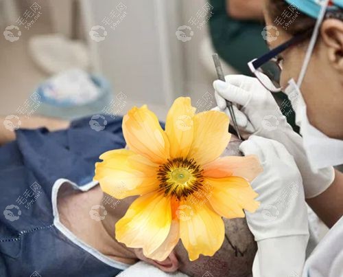 重森植发评价好