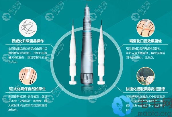 PST微针植发技术优势
