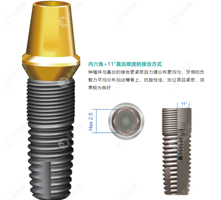 瑞士 Tplus 种植体设计