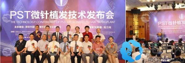 深圳鹏程PST微针植发技术发布会