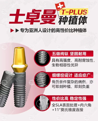士卓曼Tplus是中高端档次植体