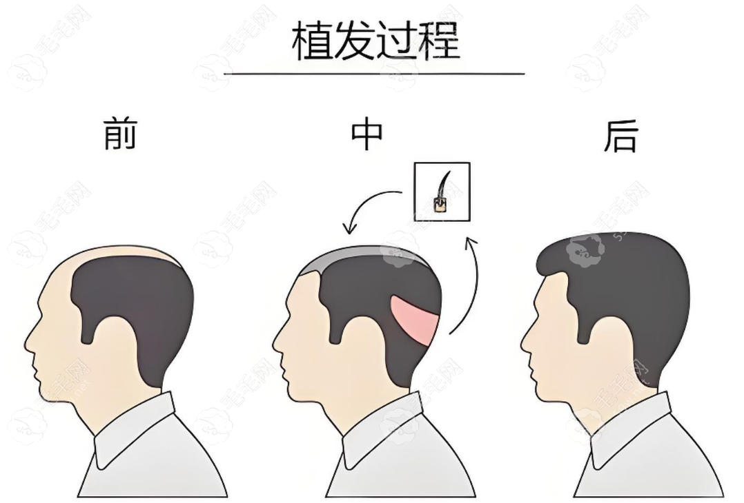 怎么预约梁爱峰医生