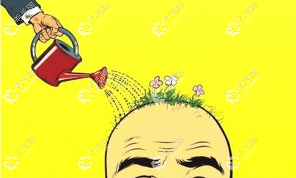 赤峰植发价格是多少