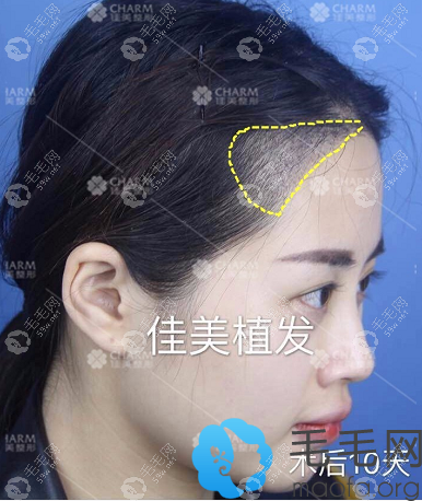 側(cè)面照片