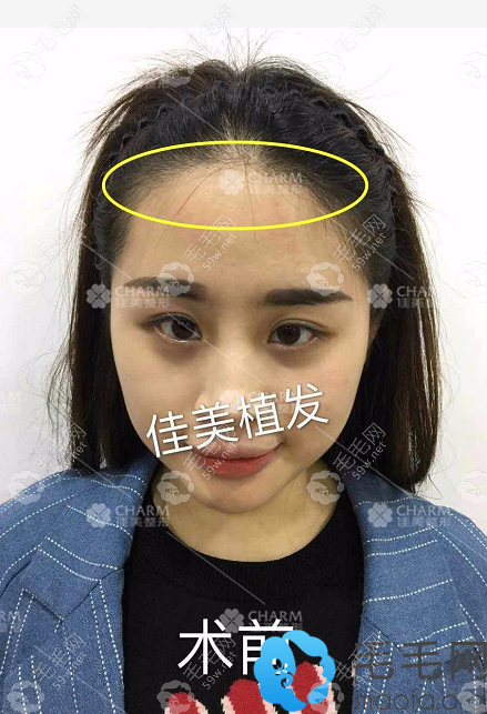 ?；ㄖ舶l(fā)前