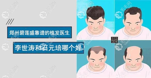 郑州碧莲盛植发医生哪个好