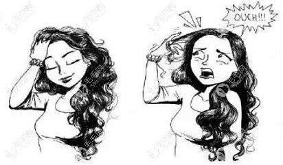 女性脂溢性脱发是什么原因引起的