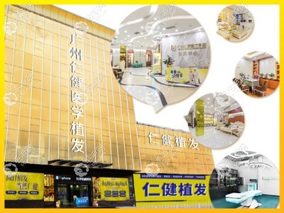 廣州仁健植發(fā)的價(jià)格一般多少