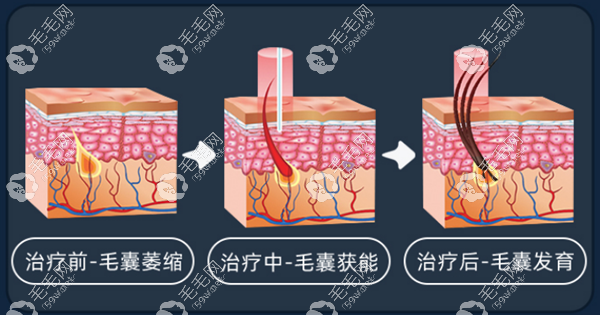 从i黑密生发原理看它怎么样