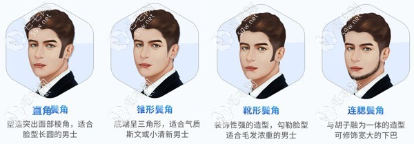 种植鬓角价钱怎么算？www.59w.net