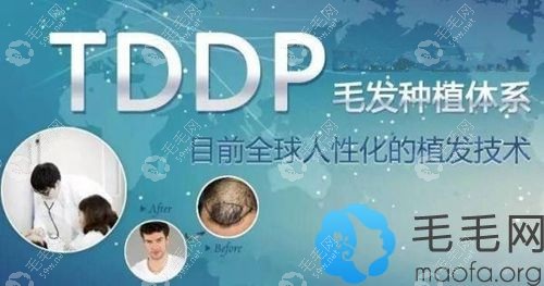 TDDP毛发种植技术原理