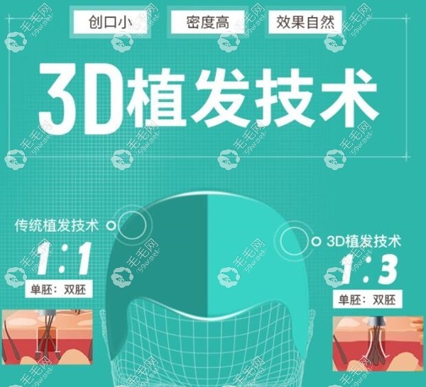 干货!这有武汉新生3D植发技术的价格(包含后续理疗的收费)