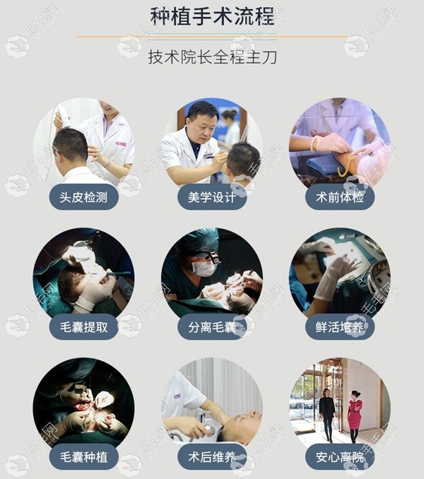 米蘭柏羽植發(fā)手術流程