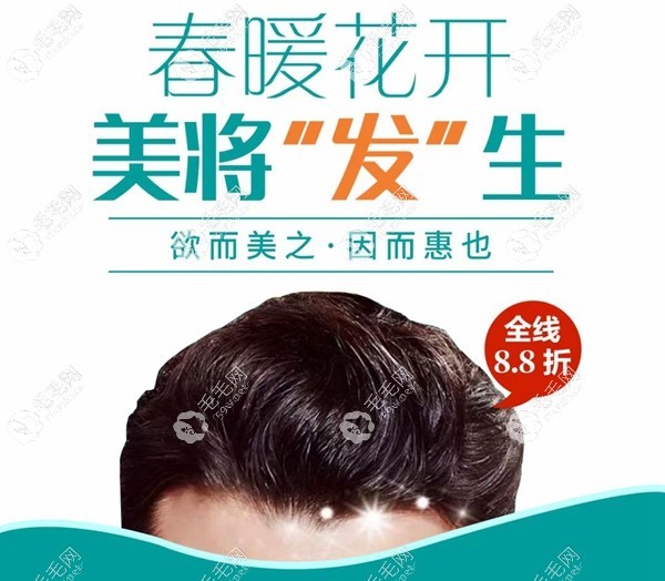 西安米蘭柏羽植發(fā)優(yōu)惠活動
