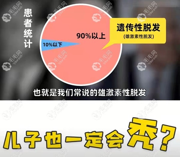 秃顶脱发会遗传下一代吗